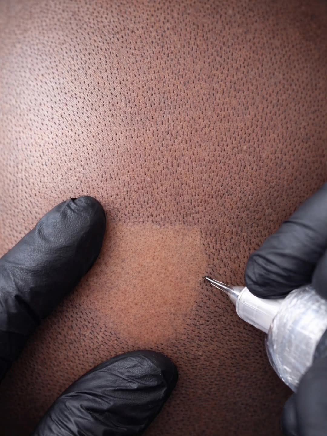 Medical tattoo result 2