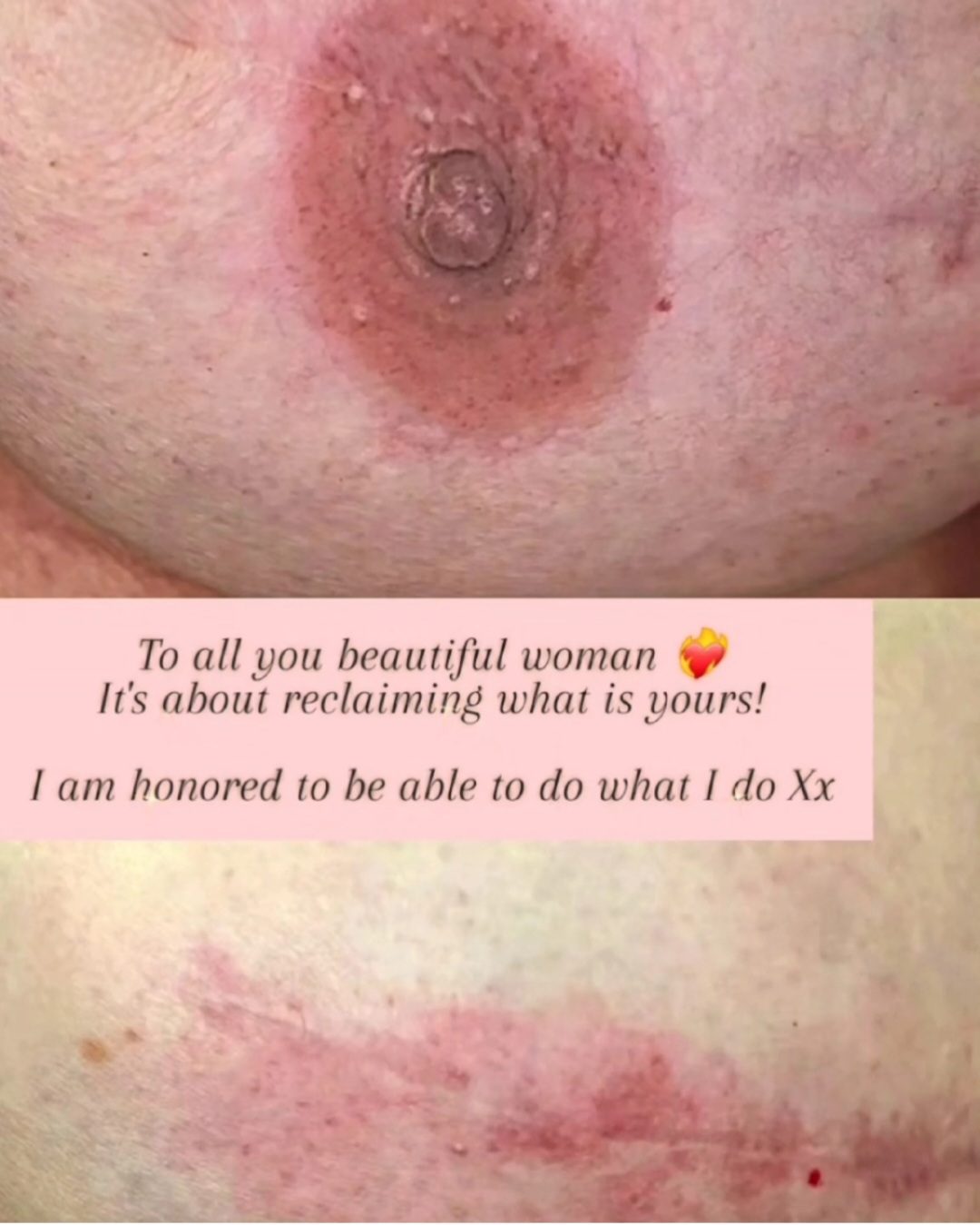 Medical tattoo result 12